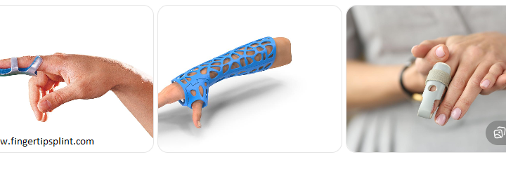 orthopedic splints for finger fractures