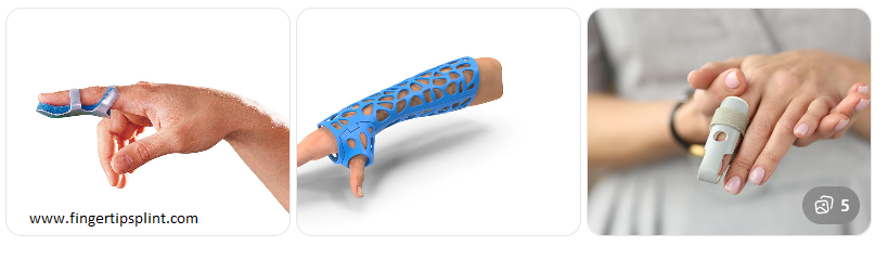 orthopedic splints for finger fractures