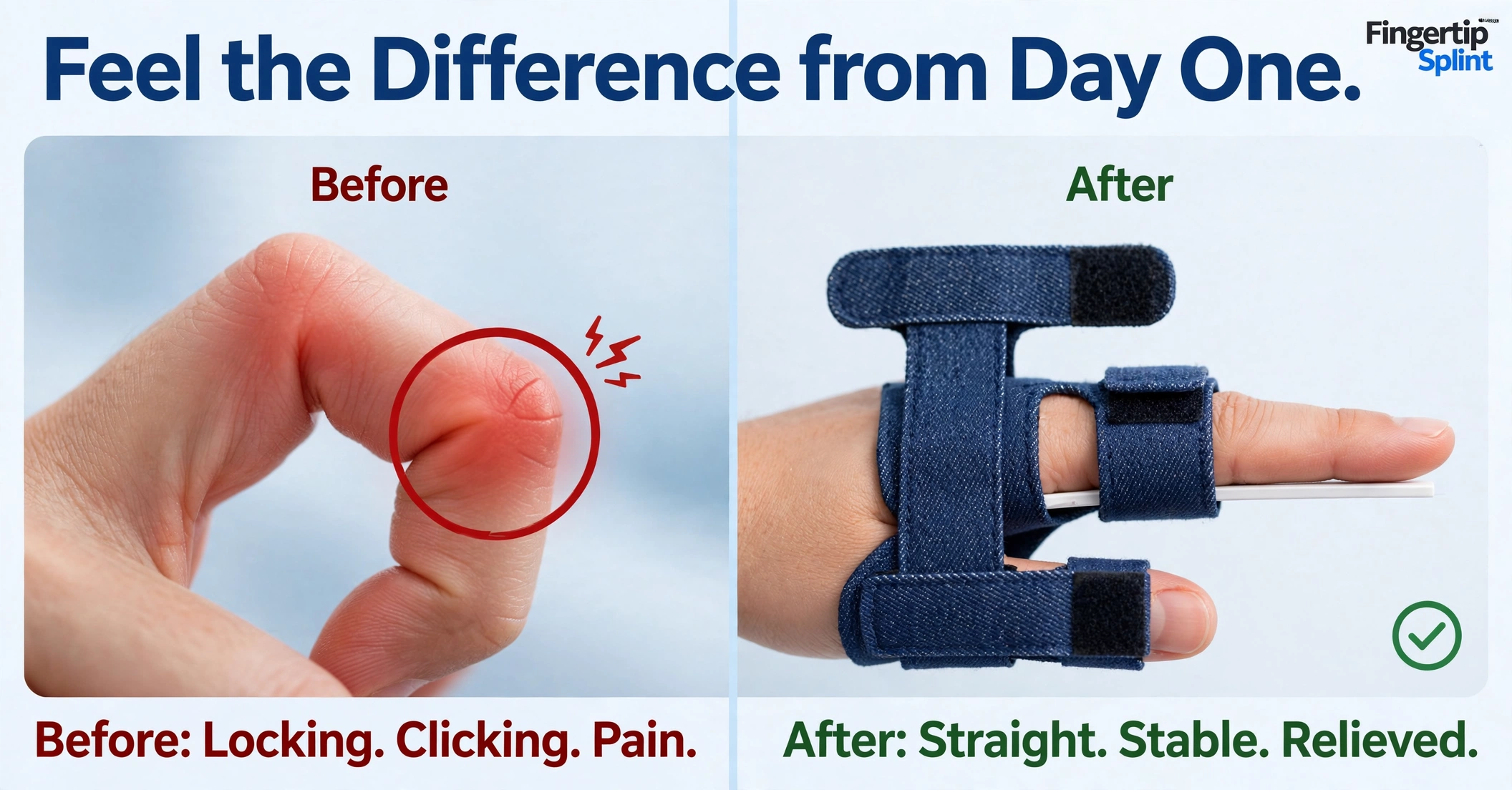 Trigger finger splint support for finger stiffness and catching
