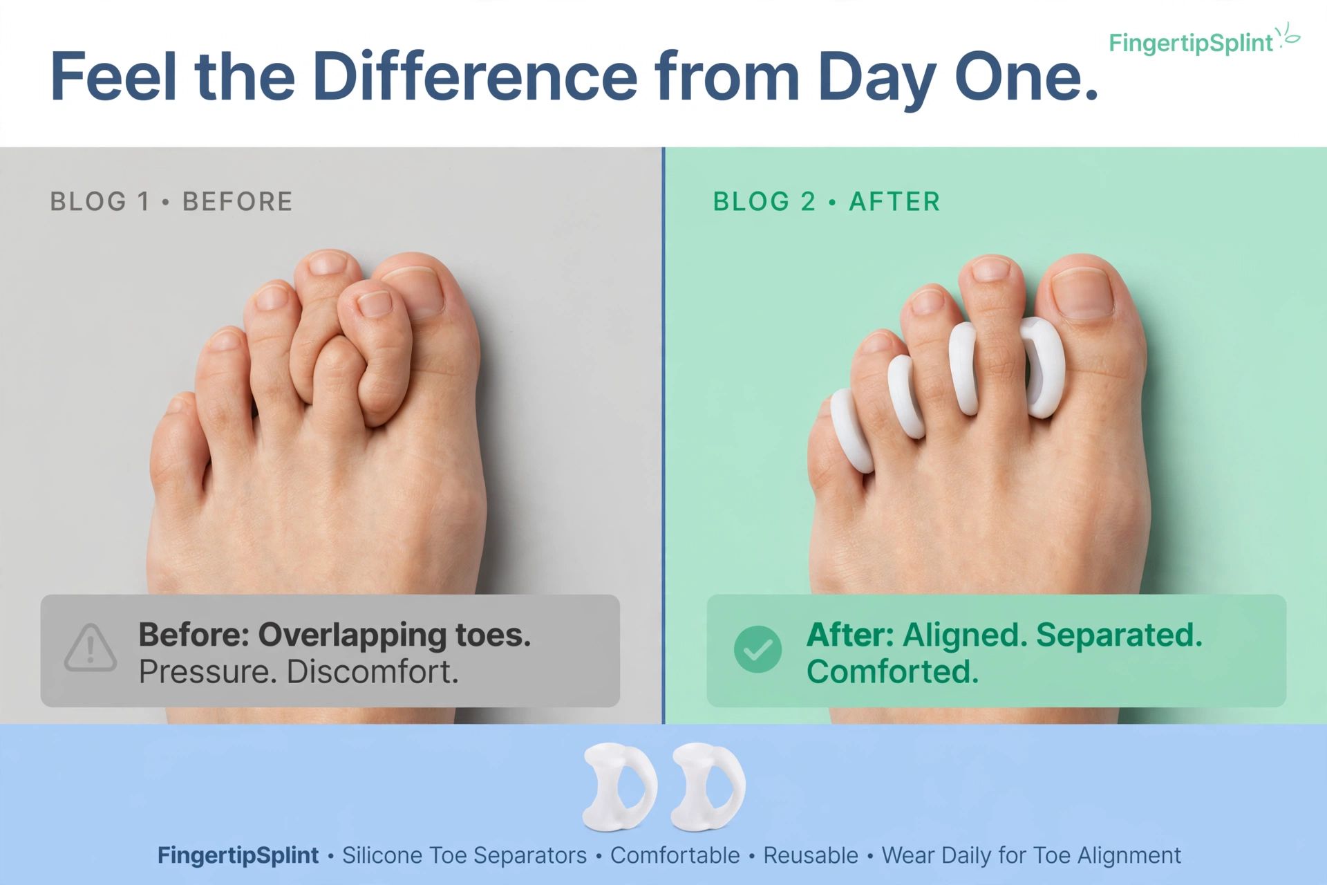 Silicone toe and finger separators for comfort and protection