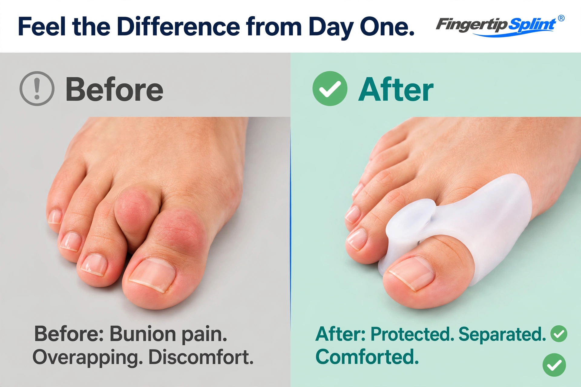 Silicone toe separators for foot comfort and pressure relief
